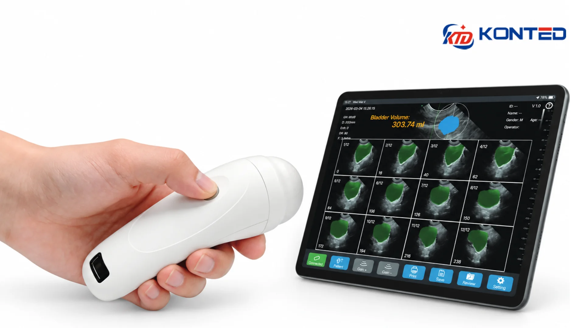 KONTED C10P BLADDER MEASUREMENT PROBE
