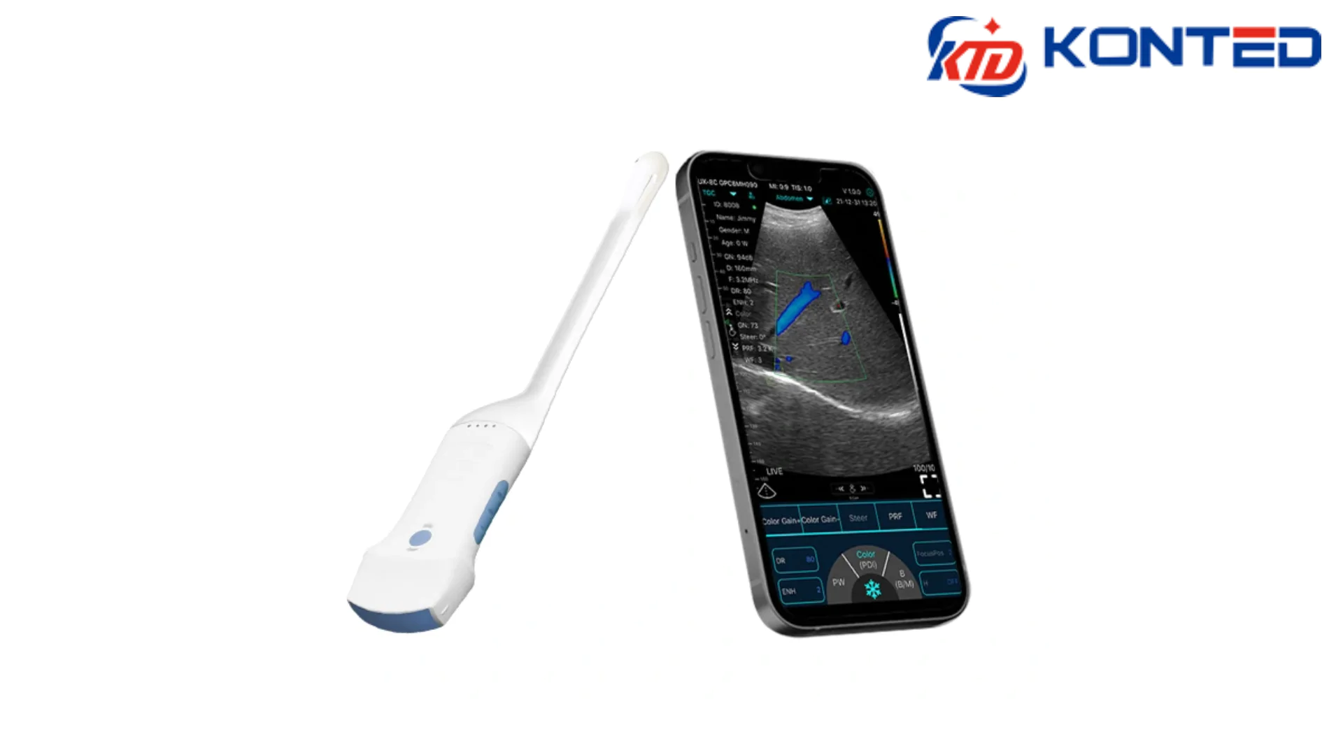 KONTED C10RC ENDOCAVITY & CONVEX WIRELESS HAND-HOLD ULTRASOUND DEVICE