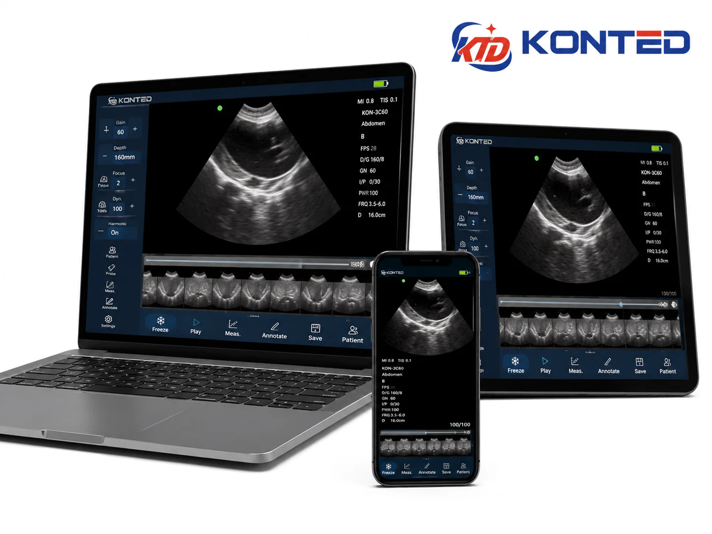 KONTED C1O RL PRO 3'ü 1 ARADA (LINEER,KARDİYAK,KONVEKS) KABLOSUZ EL TİPİ ULTRASON CİHAZI