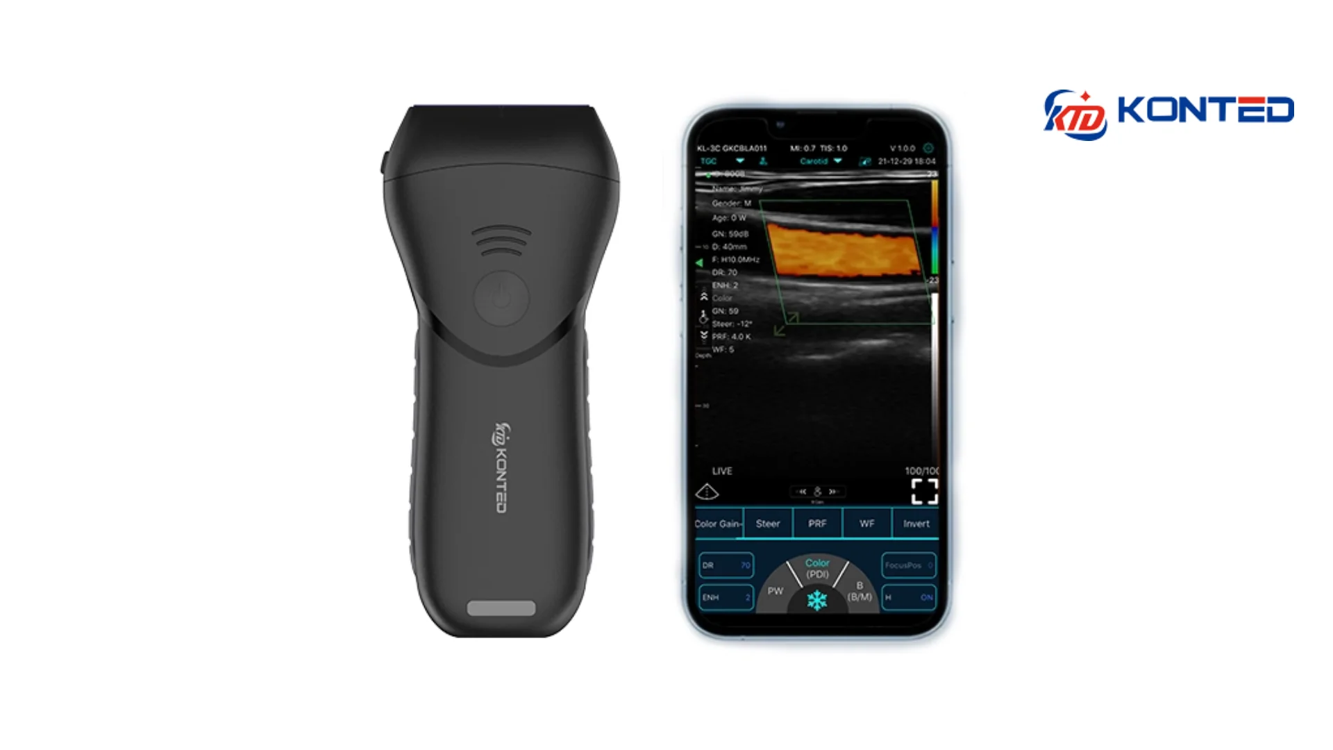 KONTED C10 MX PRO LINEER EL TİPİ KABLOSUZ ULTRASON