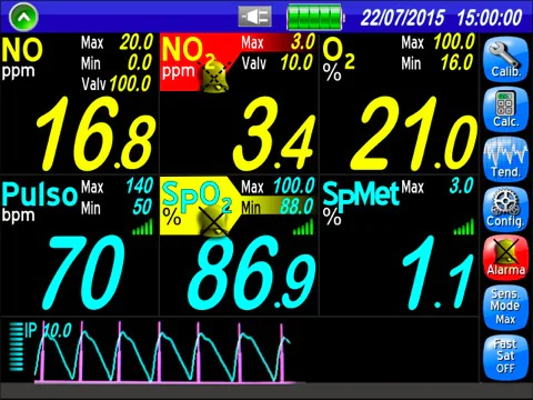 Nitrik Oksit Monitörü