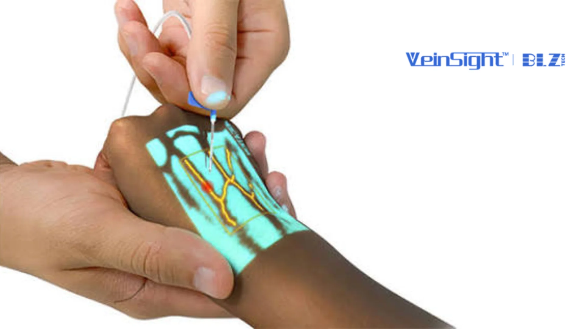 VEINSIGHT VS-500 Neonatal & Pediatric Vein Viewer