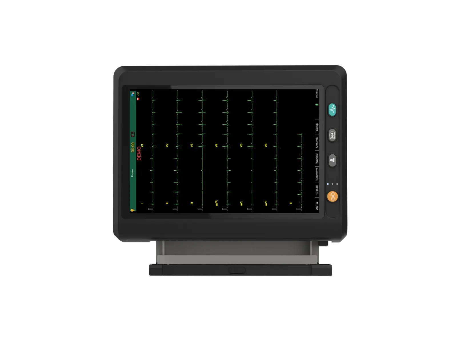 ECG-301 12 KANALLI EKG CİHAZI